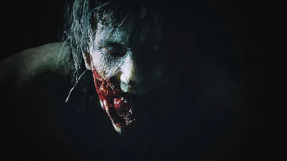 ✅❤️RESIDENT EVIL 2 DELUXE EDITION❤️XBOX ONE|XS🔑КЛЮЧ